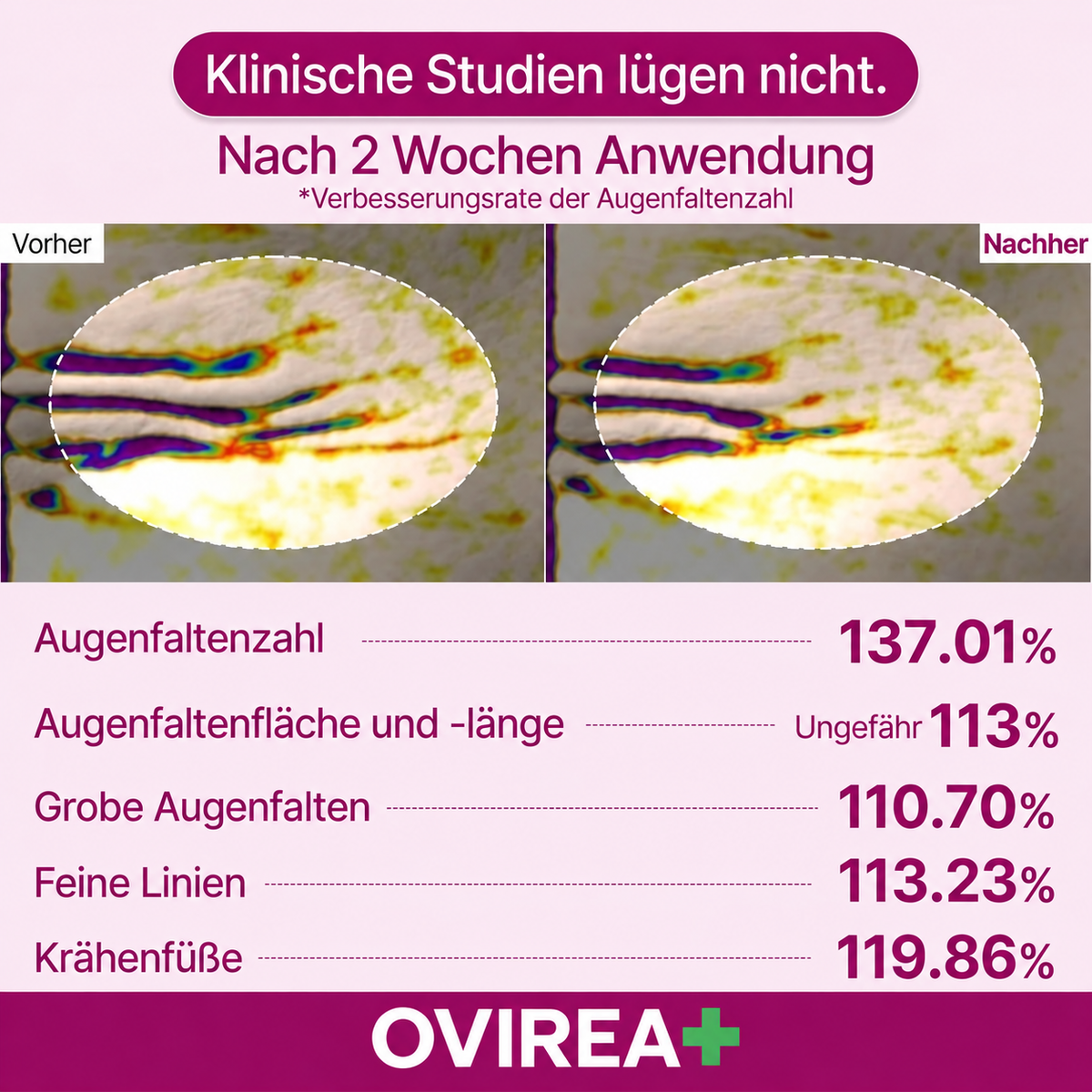 Calcium-Augenauflagen gegen Falten