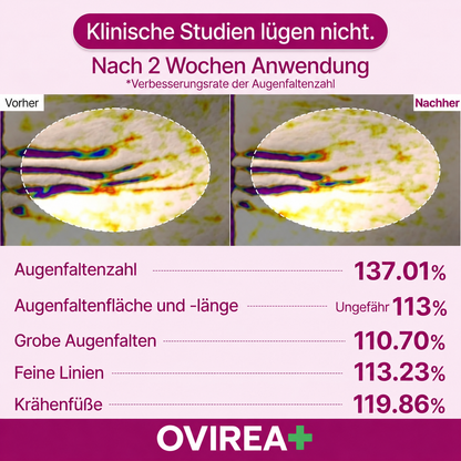 Calcium-Augenauflagen gegen Falten